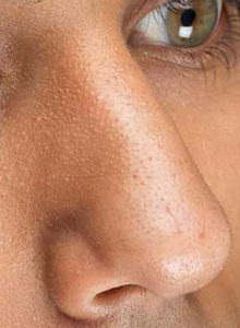 Nose